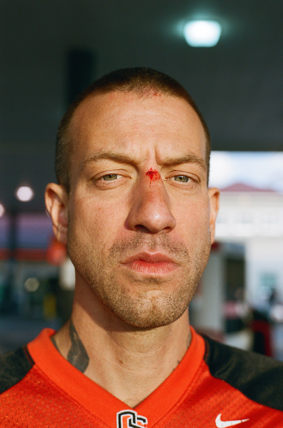 Brian Anderson with a swimming injury sustained in Florida. Photo shot by Ben Colen